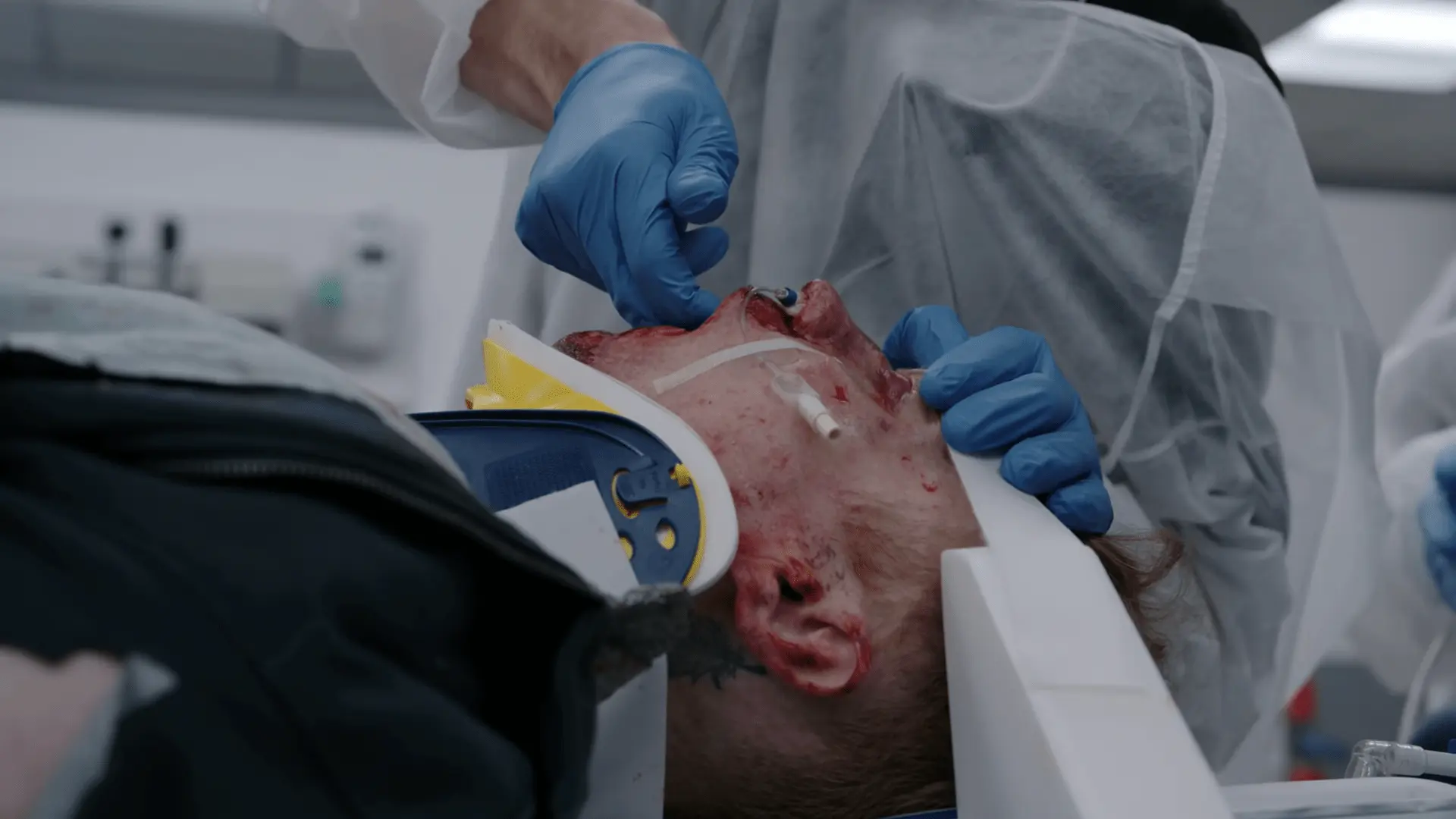 Manobra de exame físico para avaliar instabilidade do terço médio da face e dissociação craniofacial.