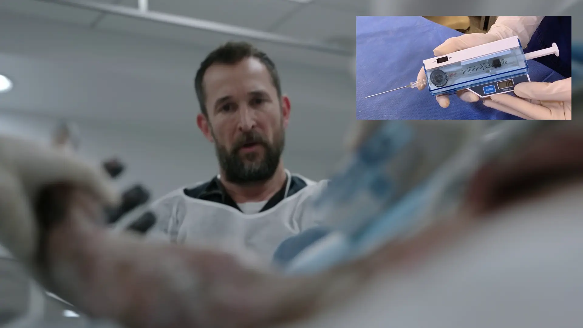 STIC device reading a compartment pressure of 49 mmHg.