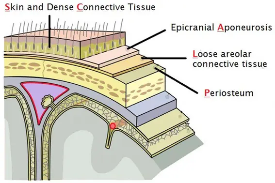Diagrama esquemático das camadas do couro cabeludo (acrônimo SCALP em inglês), ilustrando a anatomia relevante para o reparo de uma laceração profunda.