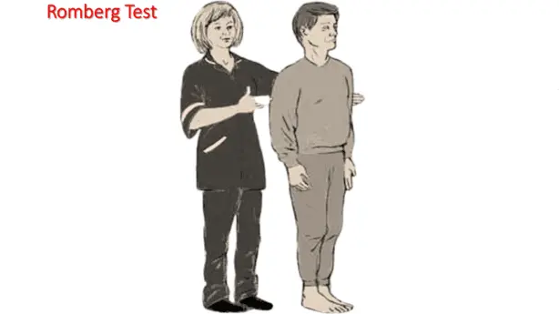 患者に対してロンベルグ試験を実施する医療従事者のイラスト。