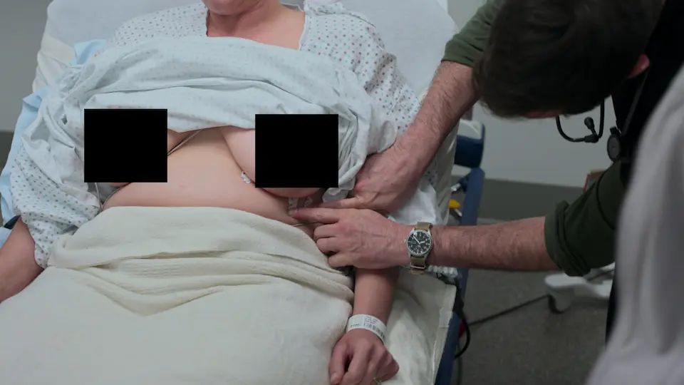 Mauvais positionnement des électrodes de l'ECG 12 dérivations par l'équipe préhospitalière, concluant à tort à l'absence de STEMI.