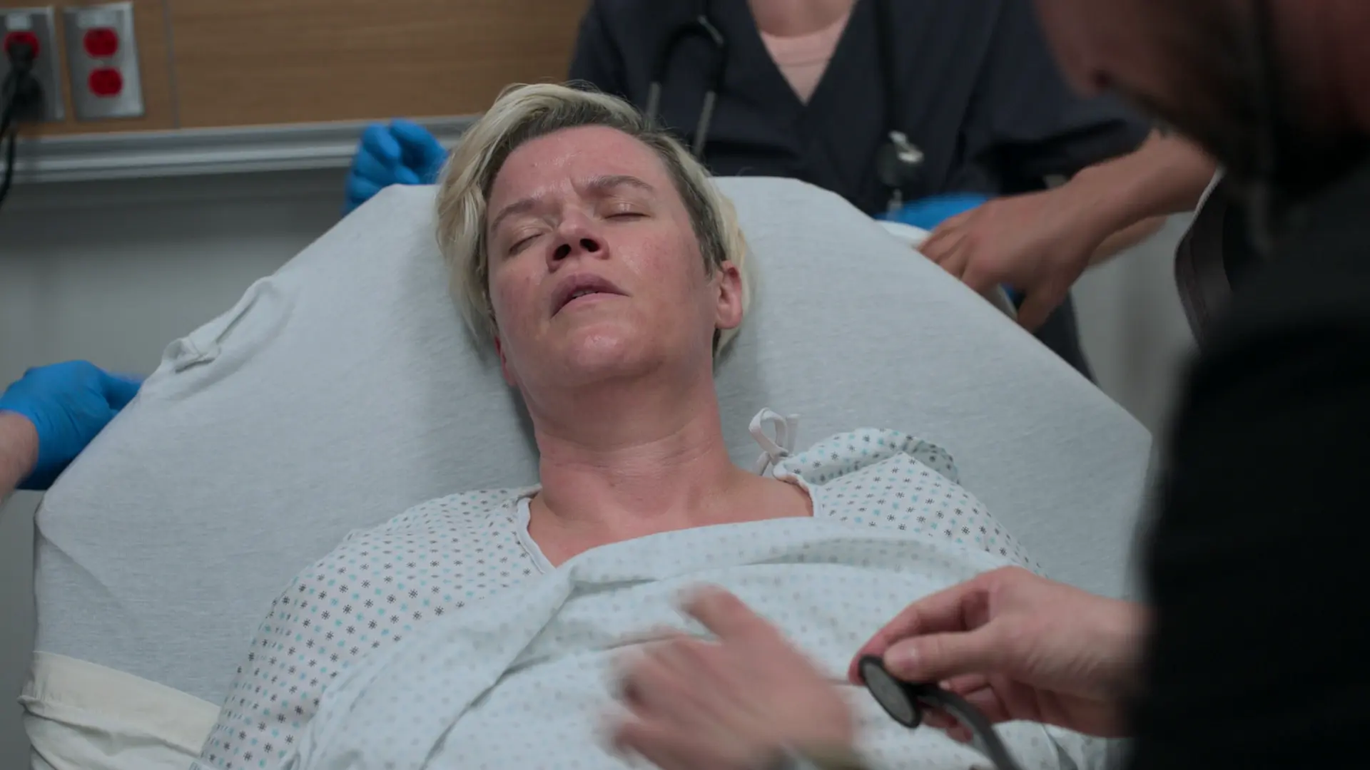 Patiente en TV sans pouls avant la défibrillation.