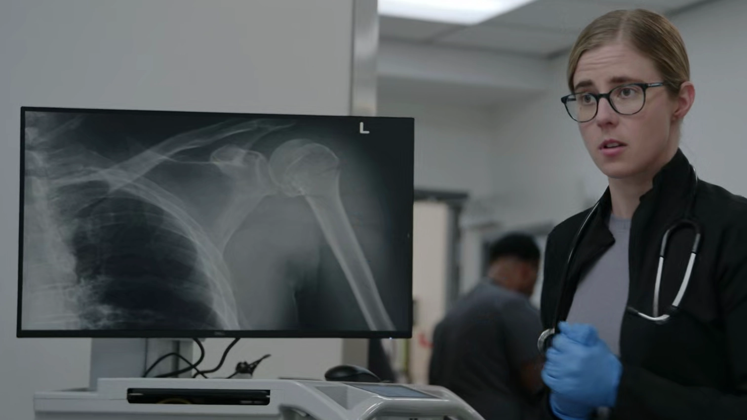 Radiografía AP del hombro izquierdo de Ginger, que muestra una fractura del húmero proximal no desplazada.