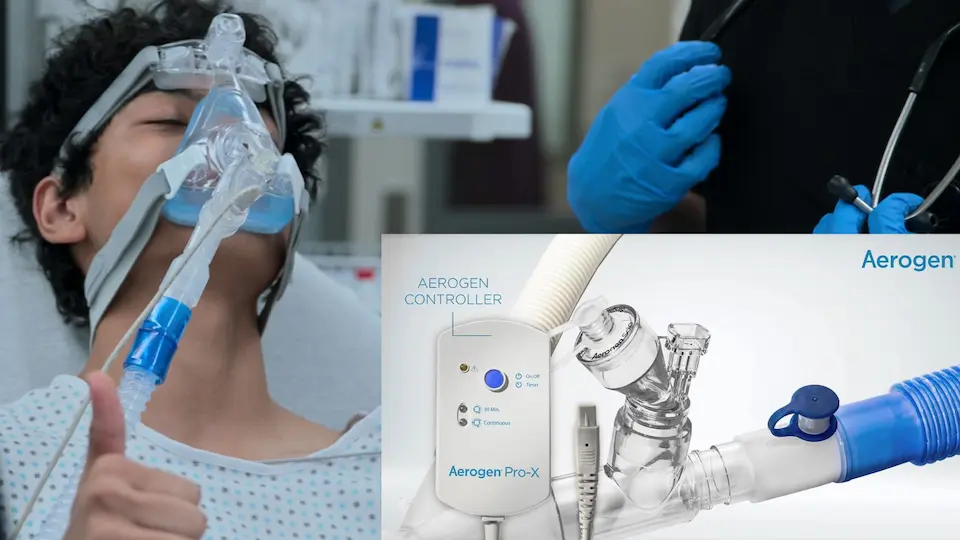 Paciente recebendo broncodilatadores nebulizados via nebulizador de malha vibratória Aerogen em linha, integrado a um circuito de BiPAP.