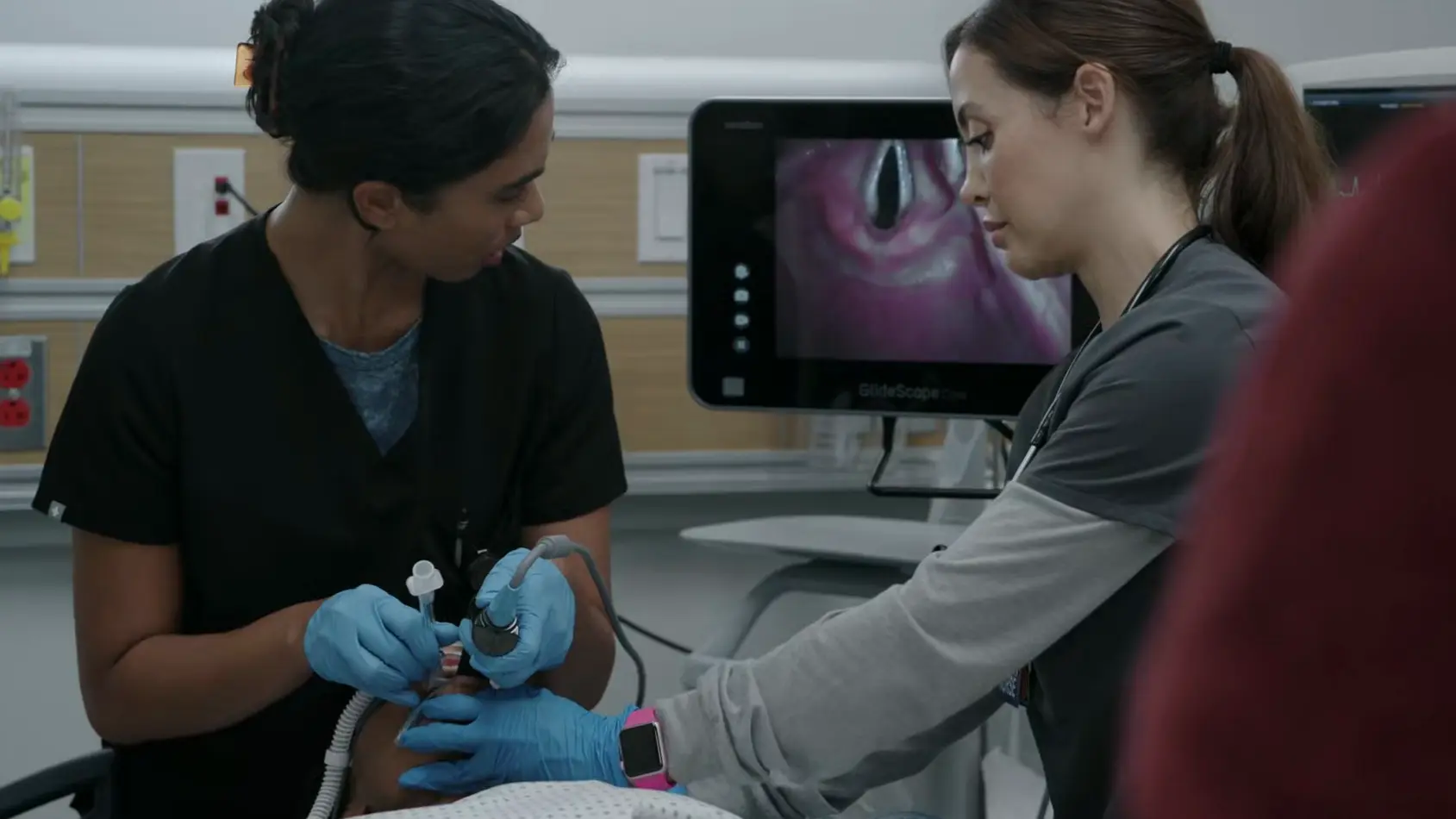 La Dra. Mohan realiza la intubación endotraqueal utilizando un videolaringoscopio GlideScope, con una visión nítida de la apertura glótica en el monitor.