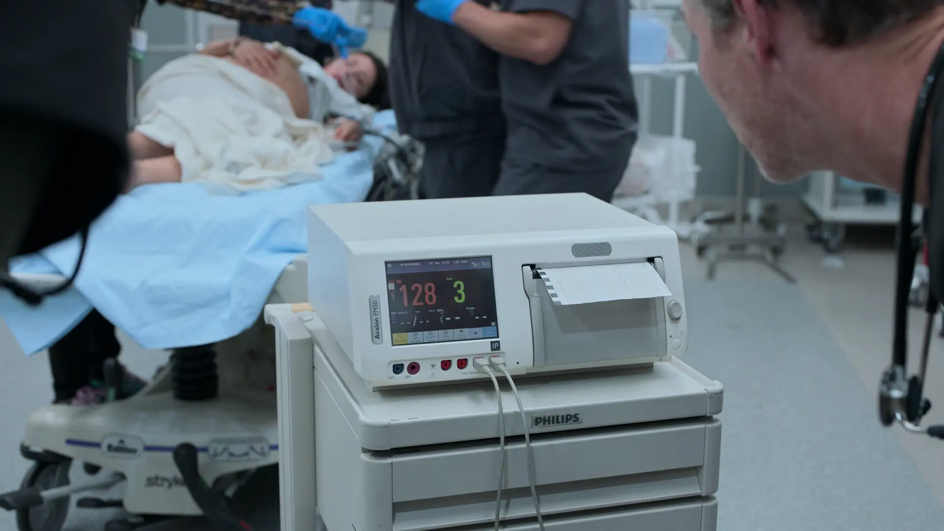 胎児心拍数128bpmという安心できる所見を示す初期のCTGモニター。