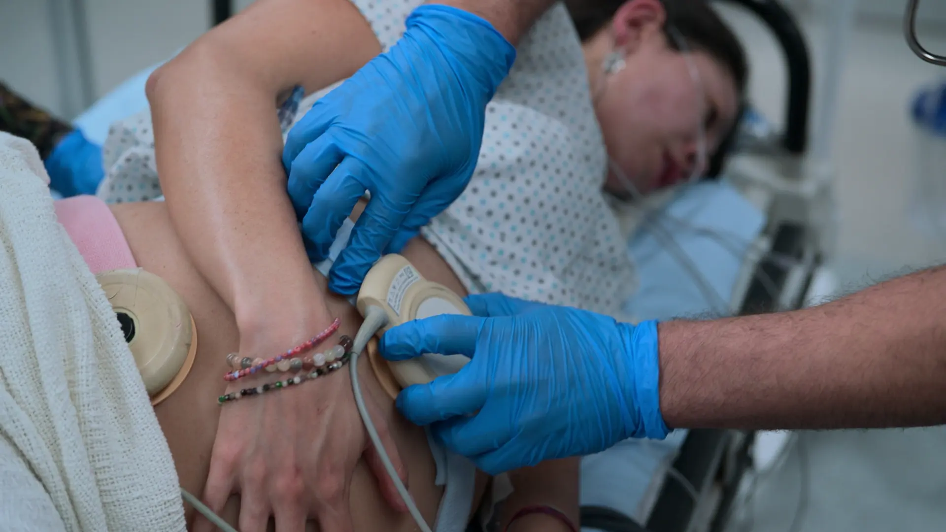 母体腹部への胎児心拍数陣痛図（CTG）トランスデューサーの装着。