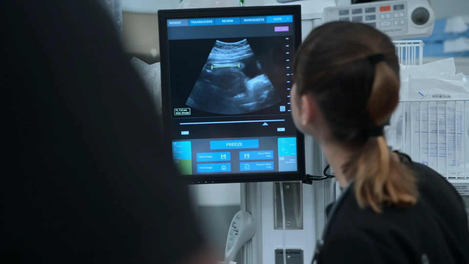 在胎週数を推定するため、胎児の大腿骨長を測定するベッドサイド産科超音波検査。