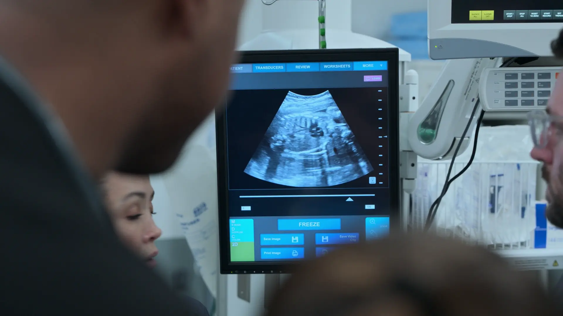 母体の痙攣発作中に胎児心拍数が90bpmまで低下していることを可視化するベッドサイド超音波。