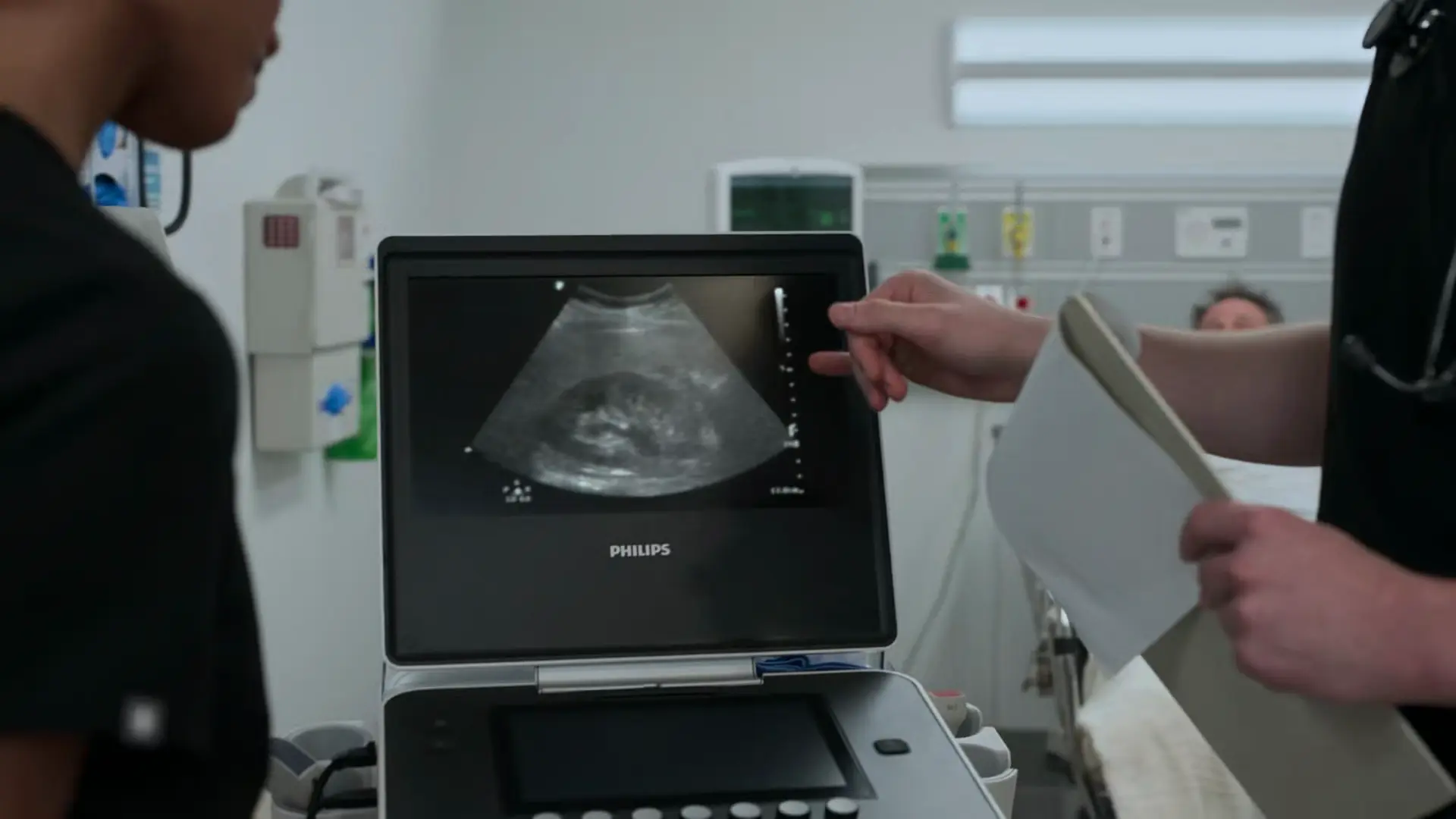 Ultrassom renal à beira-leito (POCUS) demonstrando hidronefrose leve à esquerda.