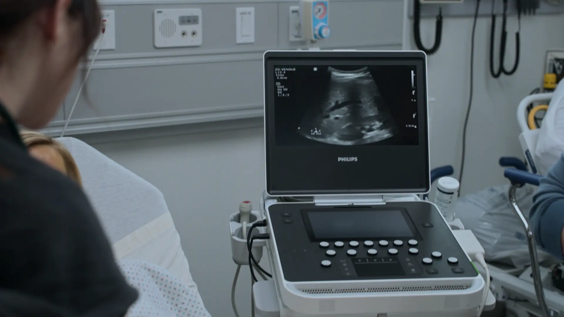 Ultrassom de Hipocôndrio Direito mostrando fígado homogêneo, sem nodularidade ou dilatação de ductos biliares.