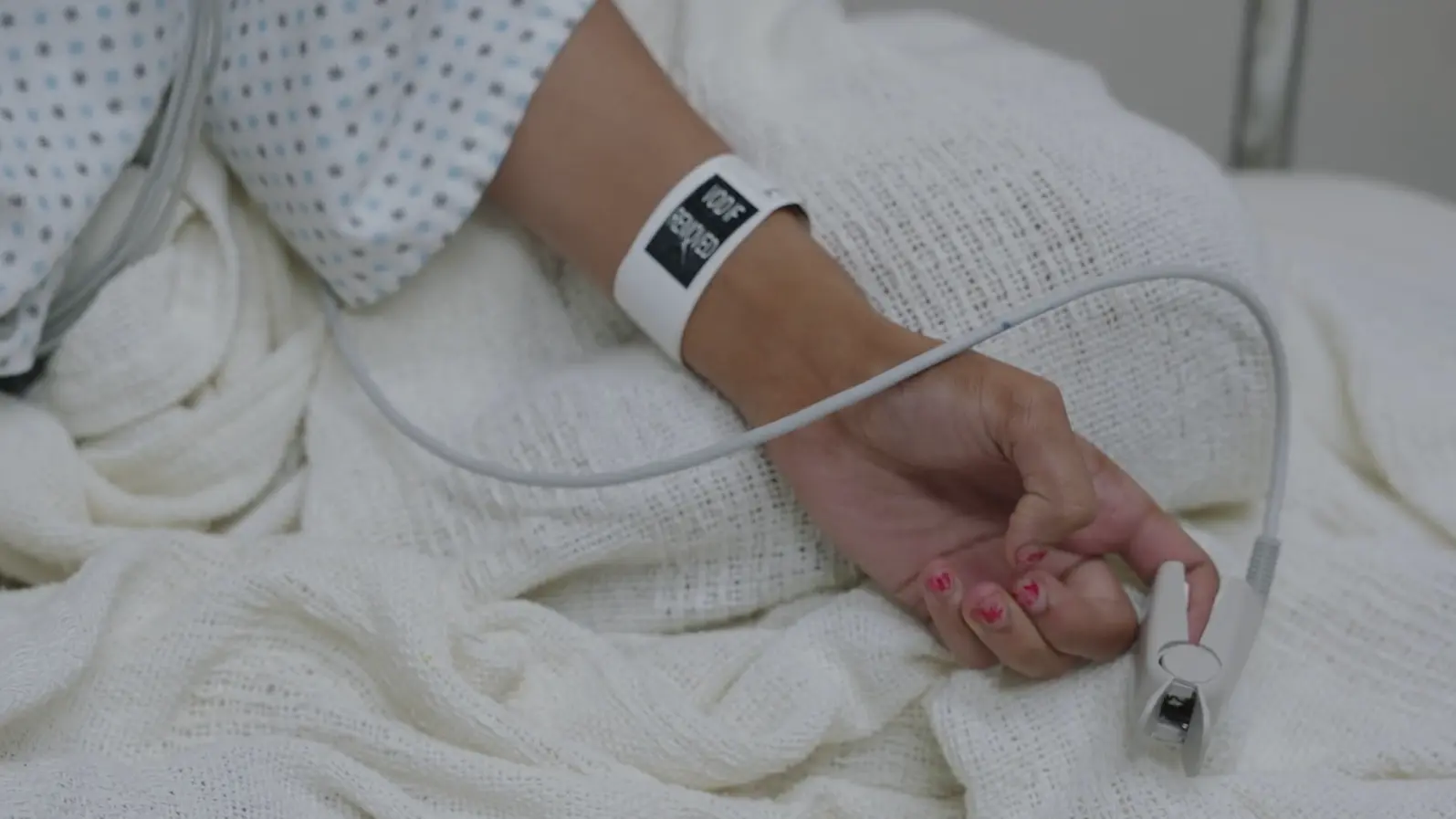 Patient's hand exhibiting tremors.