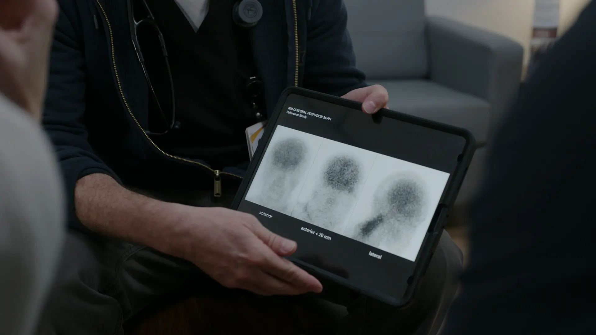 Scintigraphie de perfusion cérébrale saine (Référence)