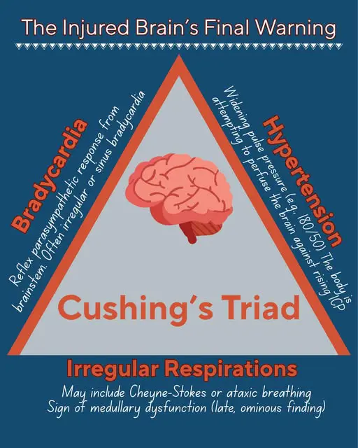 Infographic detailing Cushing's Triad: Hypertension, Bradycardia, and Irregular Respirations.