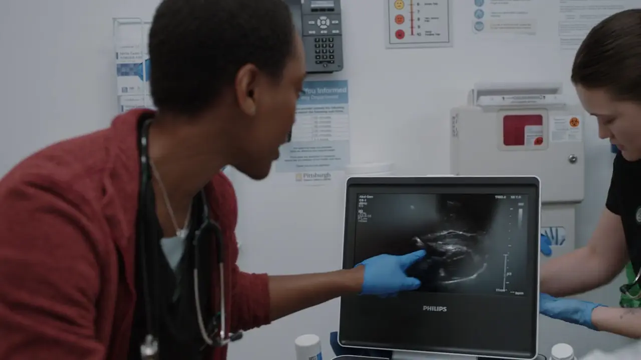 POCUS mostrando un derrame pericárdico con colapso diastólico del ventrículo derecho