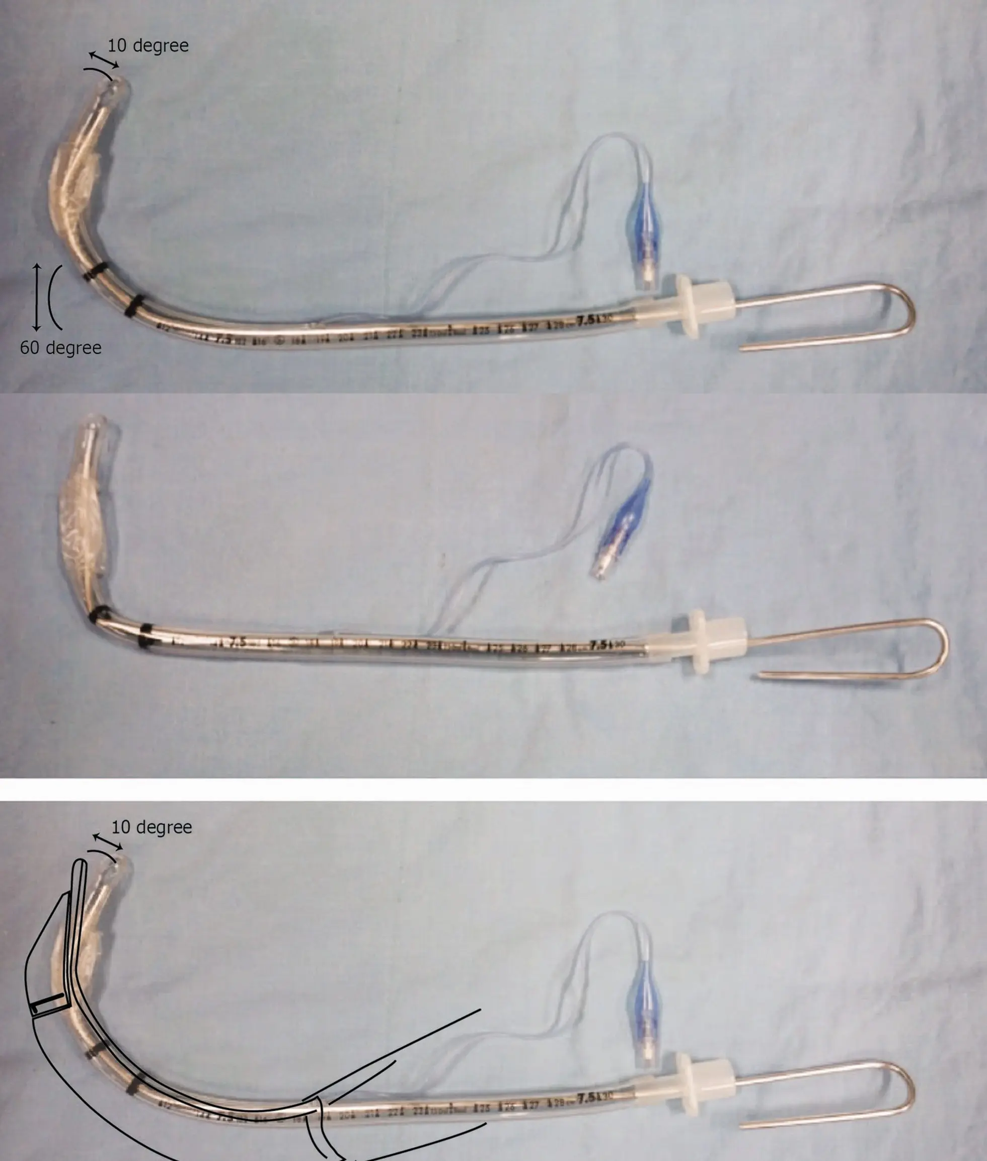 Sonde d'intubation avec un mandrin préformé en 'crosse de hockey', accompagnée d'une superposition anatomique.
